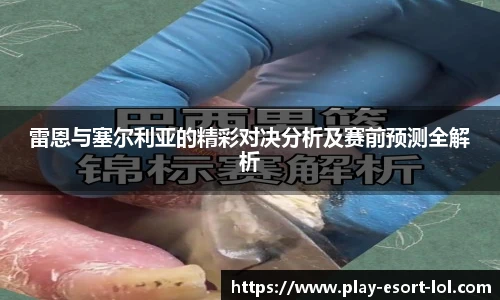 LOL竞猜大厅